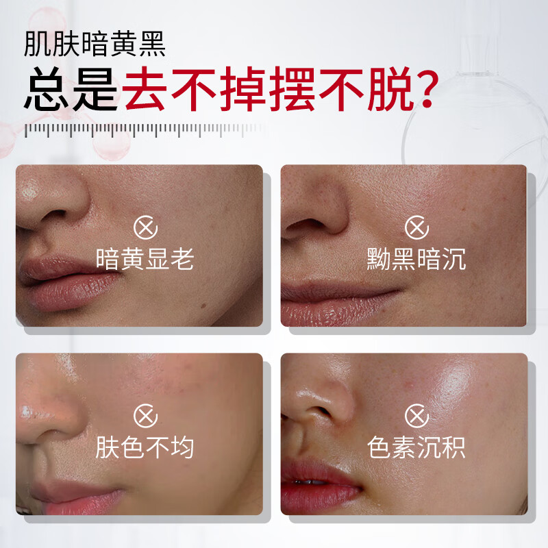 北京同仁堂甘草黄酮乳膏和熊果苷非医用美白南京皮肤研究所膏 甘草黄酮乳膏2支