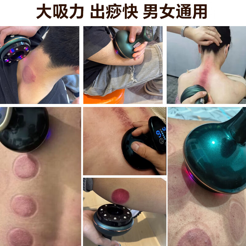 荣事达拔罐器刮痧器拔罐刮痧一体机刮痧神器拔罐家用全自动刮痧仪真空拔罐器揉腹仪送父母亲长辈节日礼物 基础款宝石红【20磁头+9档+基础礼盒】+头疗梳