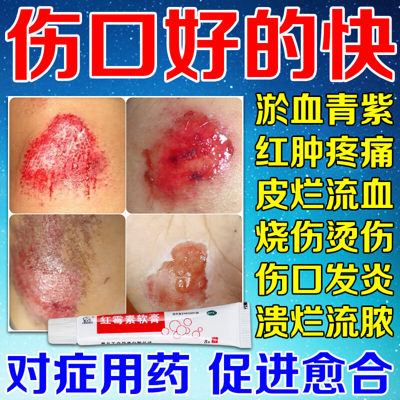 红霉素软膏 伤口愈合长肉快的药抗菌感染消炎外伤口愈合摔伤破损红肿