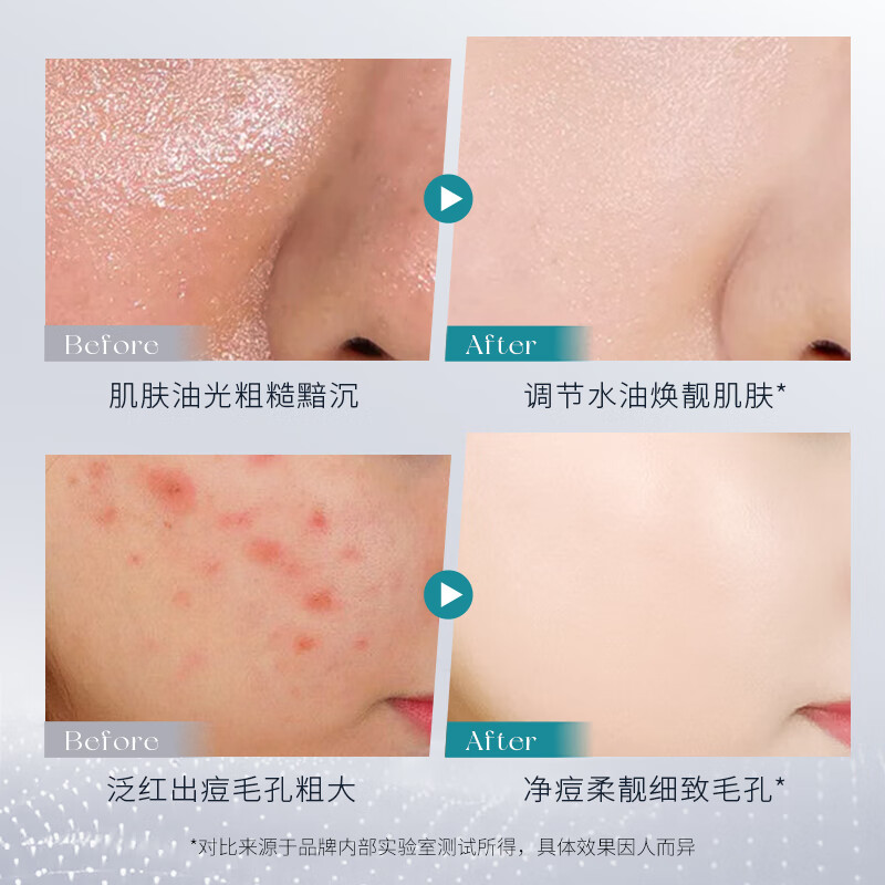 梵贞杏仁酸净透抛光精华液祛痘修护保湿改善暗沉 2瓶/560ml
