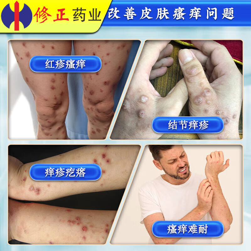 修正结节性痒疹药膏硬疙瘩皮肤瘙痒皮炎湿疹真菌感染止痒专用湿疹膏 买二送一【修正】