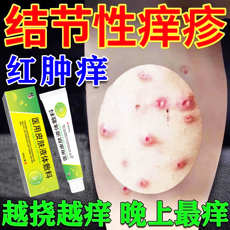 修正结节性痒疹药膏硬疙瘩皮肤瘙痒皮炎湿疹真菌感染止痒专用湿疹膏 买二送一【修正】