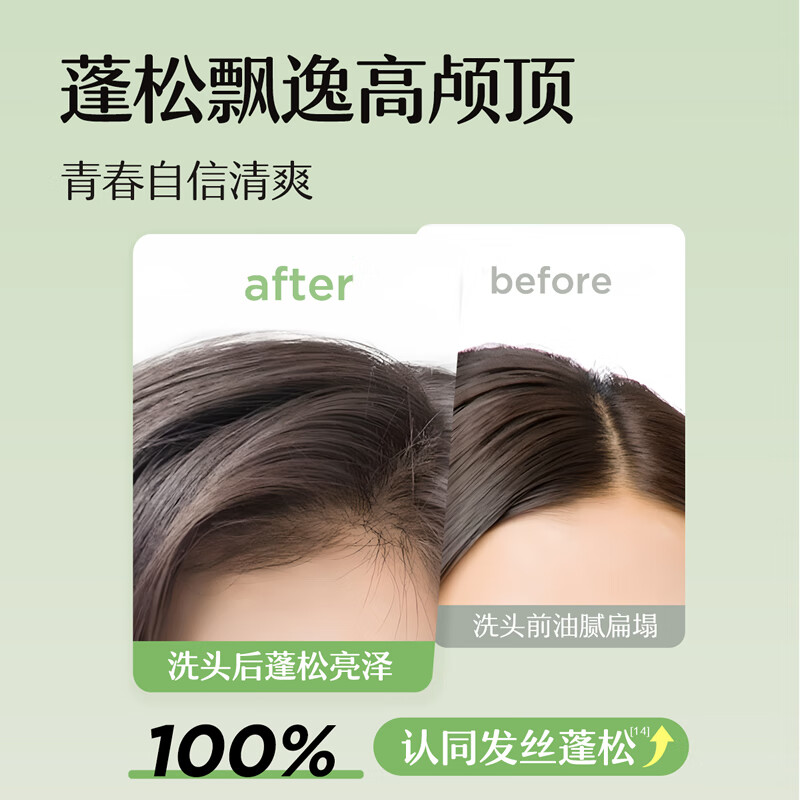 松达青少年洗发水学生党青春期男女孩控油去屑温和黄芩洗发露 【源头控油】黄芩洗发水380ml