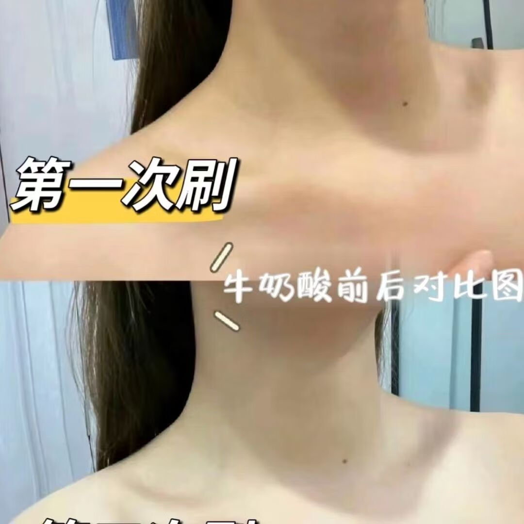 迪玛丝缇法国迪玛斯缇牛奶酸改善去角质闭口焕肤亮白身体刷酸迪马丝缇正品 欧版1盒【60ml奶酸+40ml洁面】
