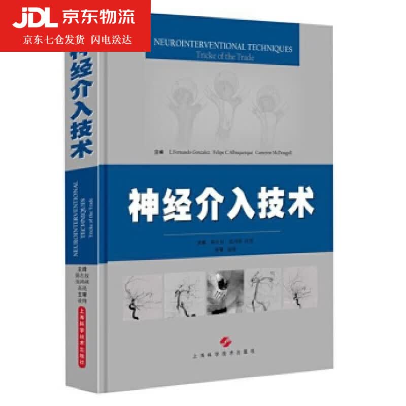 神经介入技术 L. Fernando Gonzalez Felipe C.