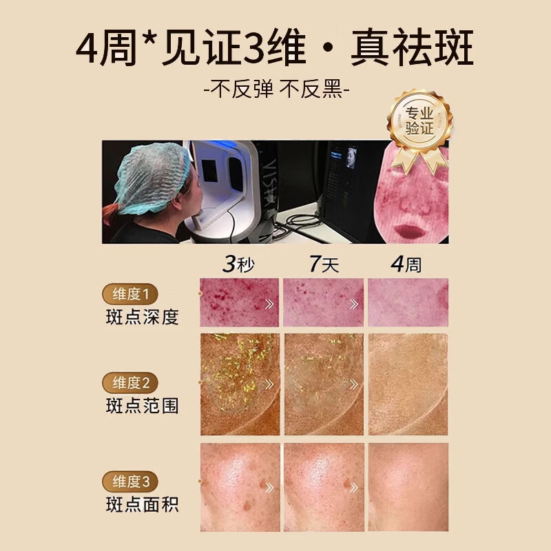 美白祛斑膏祛斑霜淡化黑色素去雀斑老年黄褐斑祛斑面霜国货护肤女 美白祛斑膏2瓶【送防晒霜】