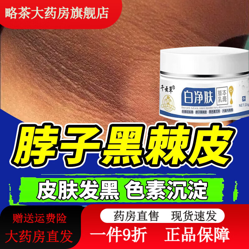 通用黑棘皮病治脖子黑色素药