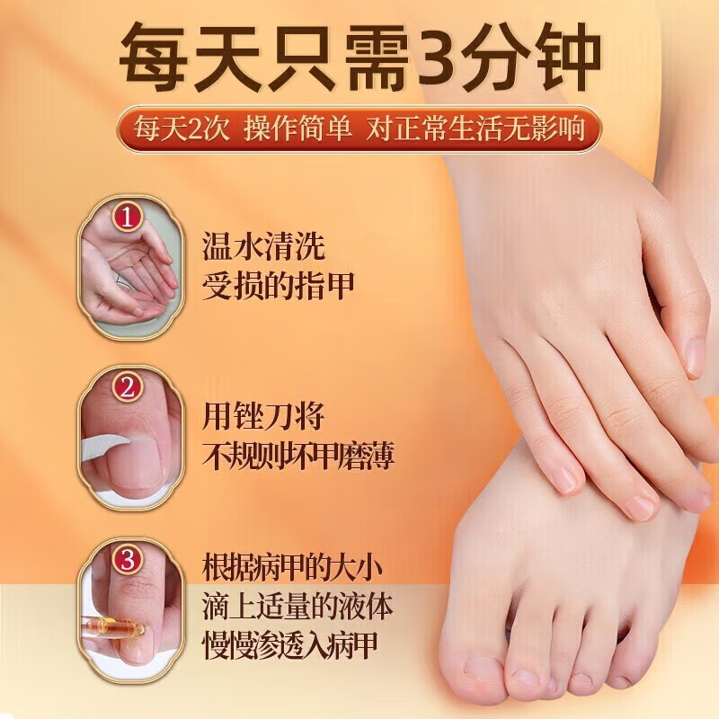 南京同仁堂灰指甲特殊效去除药变空发黄增厚真菌感染亮甲甲沟修复灰甲抑菌液 【见效装】1盒