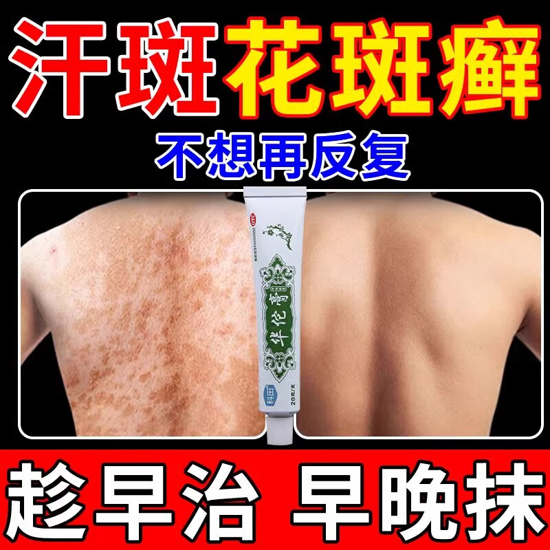 [科田] 华佗膏花斑癣专用药膏治疗汗斑的药腋下汗斑药真菌感染癣药