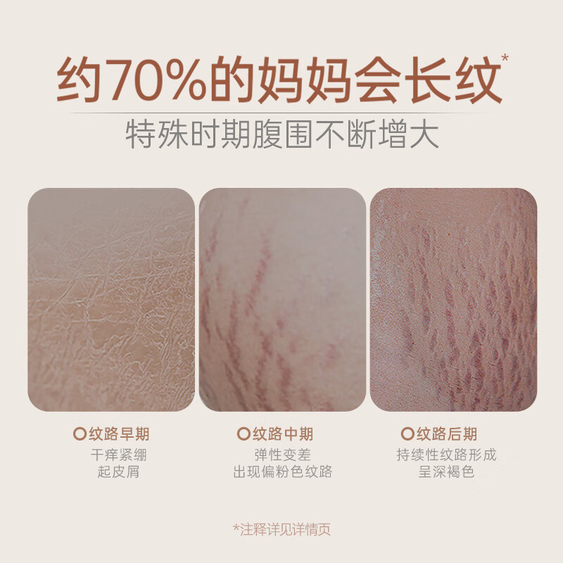 袋鼠妈妈妊娠油准孕妇改善纹路护肤品舒缓妊辰纹舒纹橄榄油精华身体按摩油 【热销爆款】舒纹橄榄油96ml