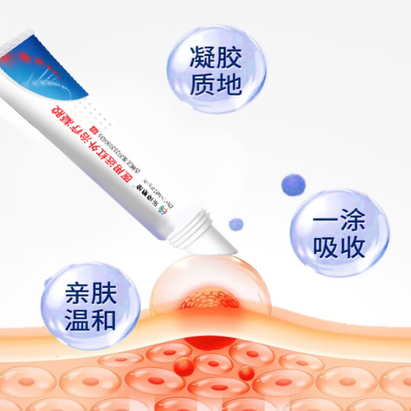 乐得惠康远红外治疗凝胶20g/支 适用于腰肌劳损、肩周炎、关节炎辅助治疗 5盒【巩固装】