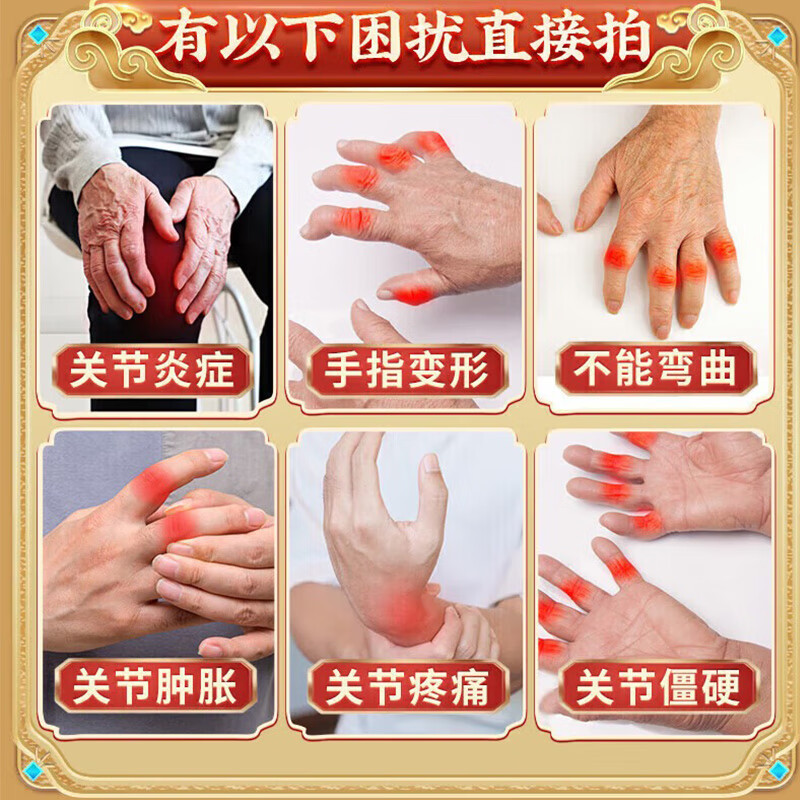 香港透骨膏类风湿性关节炎100%效药风湿膏药风湿关节疼痛专用膏药风湿止痛膏 特效1盒装【泰国透骨膏】 手指疼痛肿胀弯曲困难僵硬变形