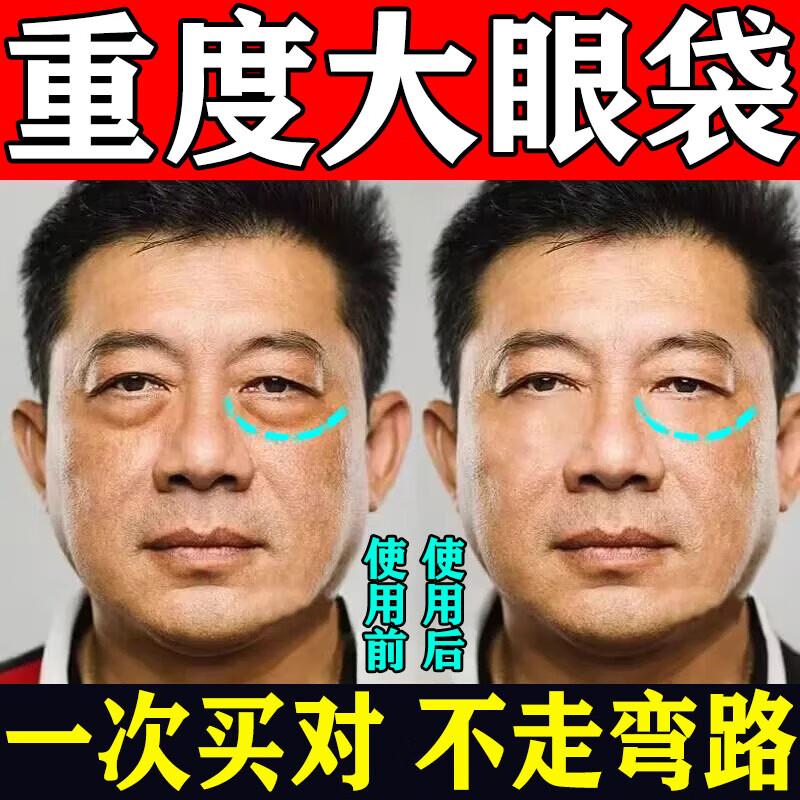 去眼袋神器老人用嚴(yán)重眼袋問題中老年男女用眼膜霜眼貼眼袋黑眼圈 一瓶裝【體驗(yàn)裝】