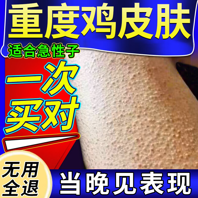 鸡皮肤疙瘩毛囊角化症专用膏(药监备案)毛周角化去角质疙瘩大腿手臂去除神器儿童磨砂霜身体乳沐浴露 买2送1【轻度适用】三盒(100%发货特效快)