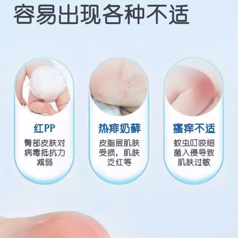 TSINGER婴儿多效霜20g 宝宝多种肌肤问题止痒膏红pp儿童户外防蚊虫叮咬霜 【两瓶装】婴儿多效霜20g*2 TSINGER婴儿多效霜20g 宝宝多种肌肤问题止痒膏红pp儿童户外防蚊虫叮咬霜 【两瓶装】婴儿多效霜20g*2
