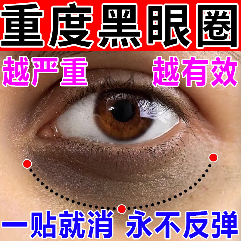 碧素堂眼贴膜淡化细纹去眼袋黑眼圈提拉紧致男女士熬夜去黑眼圈去除神器 一盒特效装【淡化黑眼圈】