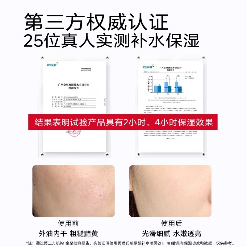 优理氏(UNES)玻尿酸原液补水喷雾男女补水保湿喷雾水妆前定妆水清透爽肤水 玻尿酸喷雾5瓶 【1000ml】