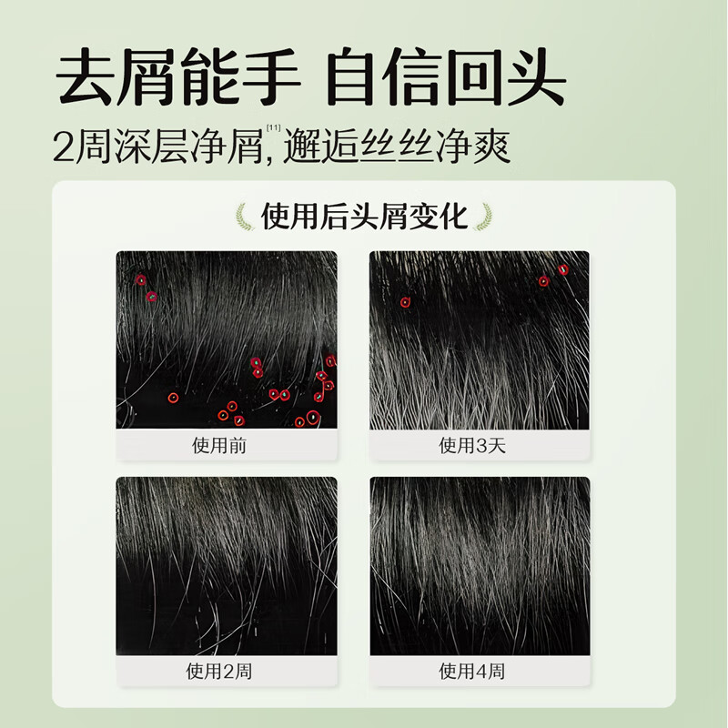 松达青少年洗发水学生党青春期男女孩控油去屑温和黄芩洗发露 【源头控油】黄芩洗发水380ml