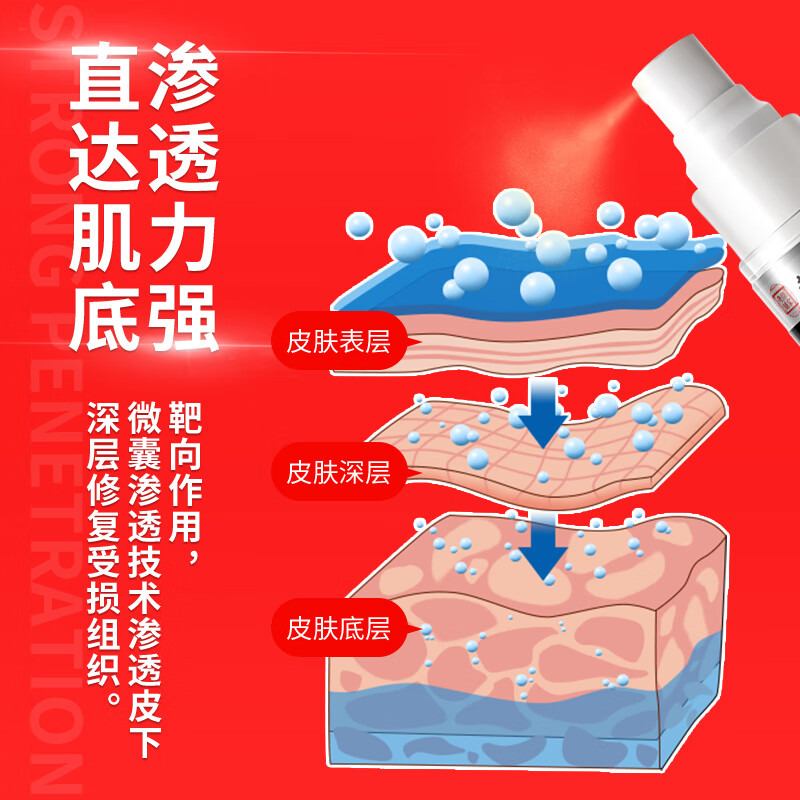 纾大夫龟头炎包皮炎专用阴囊潮湿瘙痒红肿异味红点白点念珠菌药喷雾剂 三支周期装(两支价)