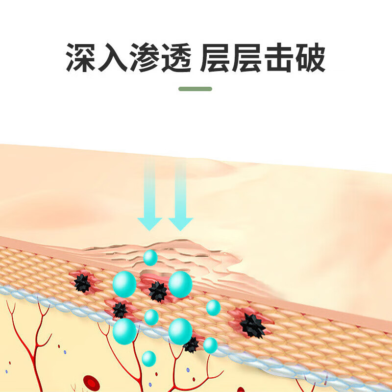 香港大药房联合集团有限公司香脚王脚气喷雾剂脚臭脚痒脚出汗脱皮水泡软膏烂臭脚搭配套装一喷一抹清爽呵护 2套【2盒喷剂+2盒乳膏】