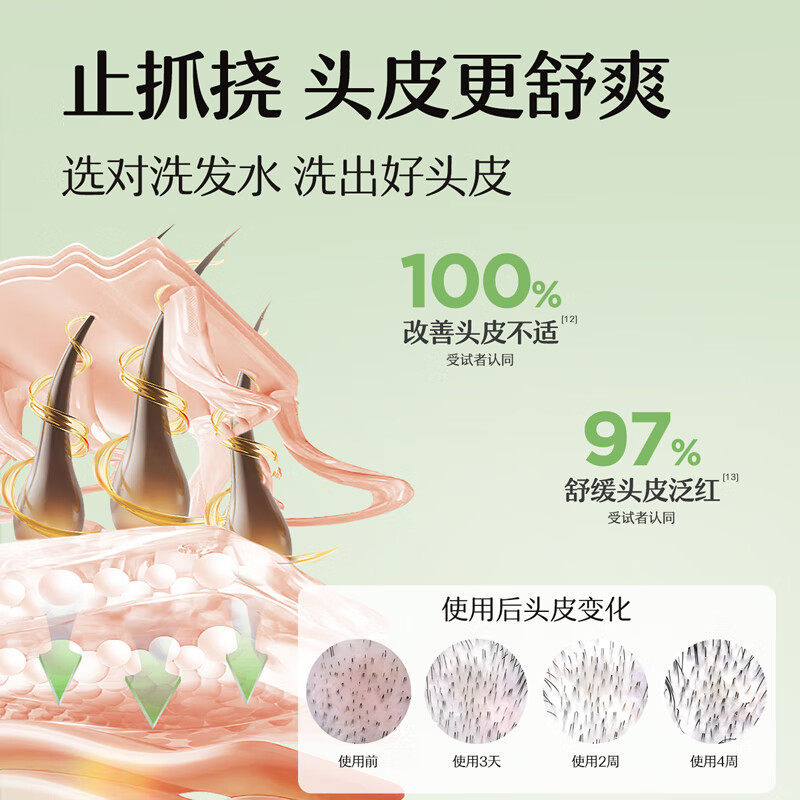 松达青少年洗发水学生党青春期男女孩控油去屑温和黄芩洗发露 【源头控油】黄芩洗发水380ml