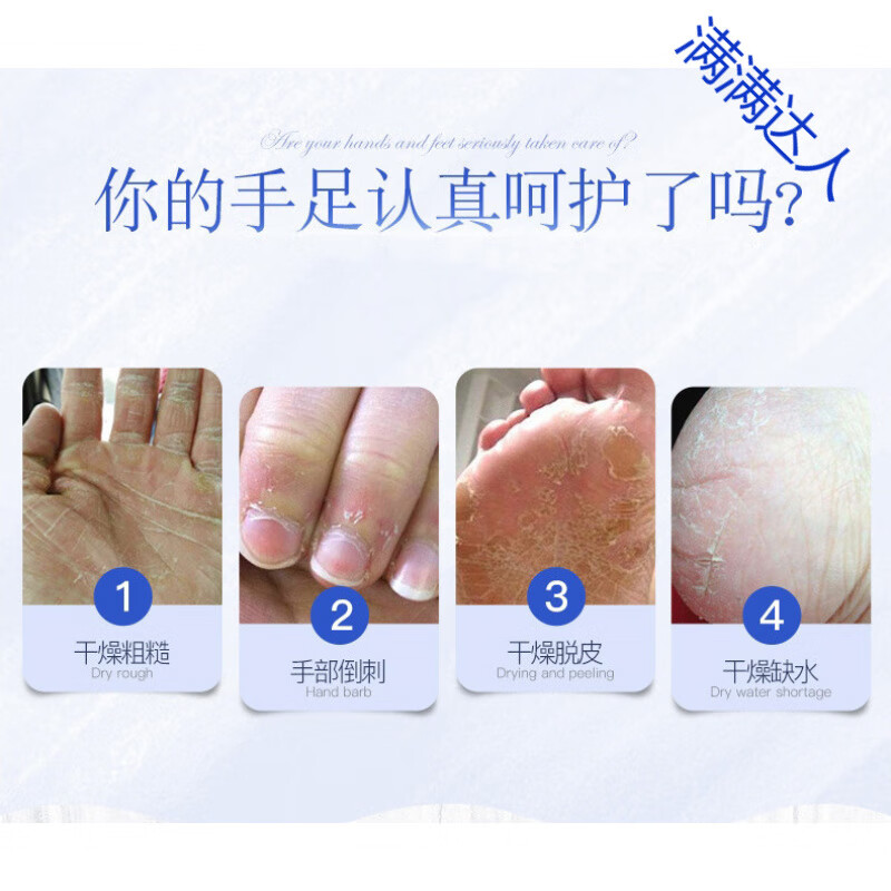 护手霜手干燥粗糙防干裂皲裂补水保湿滋润裂可宁皴裂膏 1瓶装