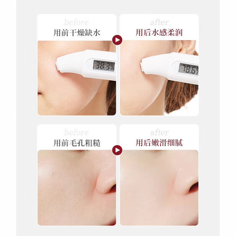 韩伦美羽5%烟酰胺马来西亚甘油护肤补水妆前保湿滋润脸部精华 500ml2瓶