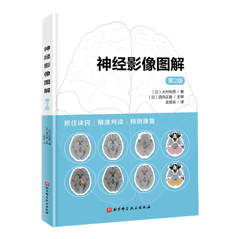 神经影像图解 第2版京东超级618