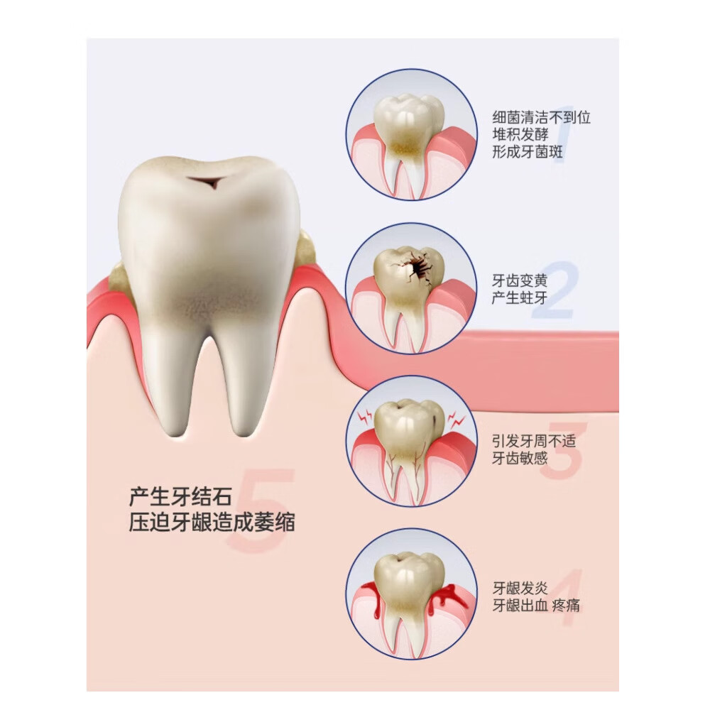 波普专研牙膏去黄脱敏抗牙菌斑牙结石清新口气亮白牙龈修护多效护理 120g*多效护理 1支 线下款白色膏体
