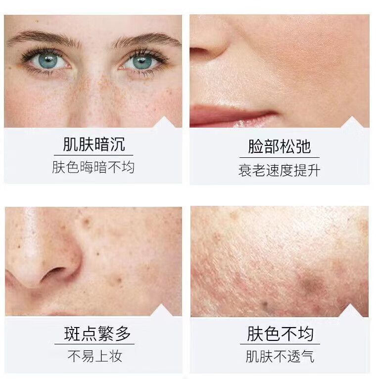 修正美白精华液白皙提亮淡色斑补水润肤黄暗沉斑点美白淡斑精华液30ml 3瓶【美白淡斑精华液】 30ml/瓶