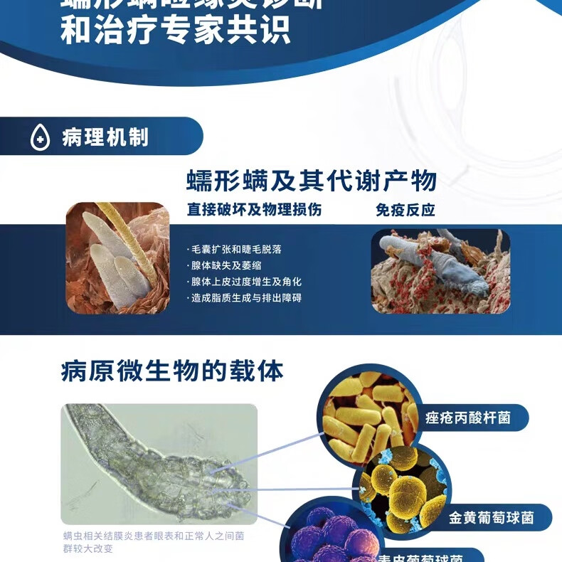 特奈斯眼小4-松油醇除螨棉片30片装 30片一盒
