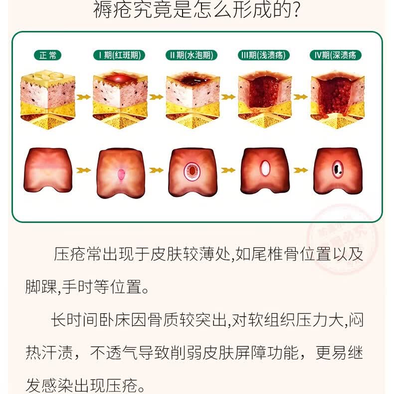 爱筑天伦防褥疮垫卧床老人久躺神器臀部防压疮病人屁股尾椎骨护理轮椅坐垫 浅灰色抗菌纯棉 T字舒压款