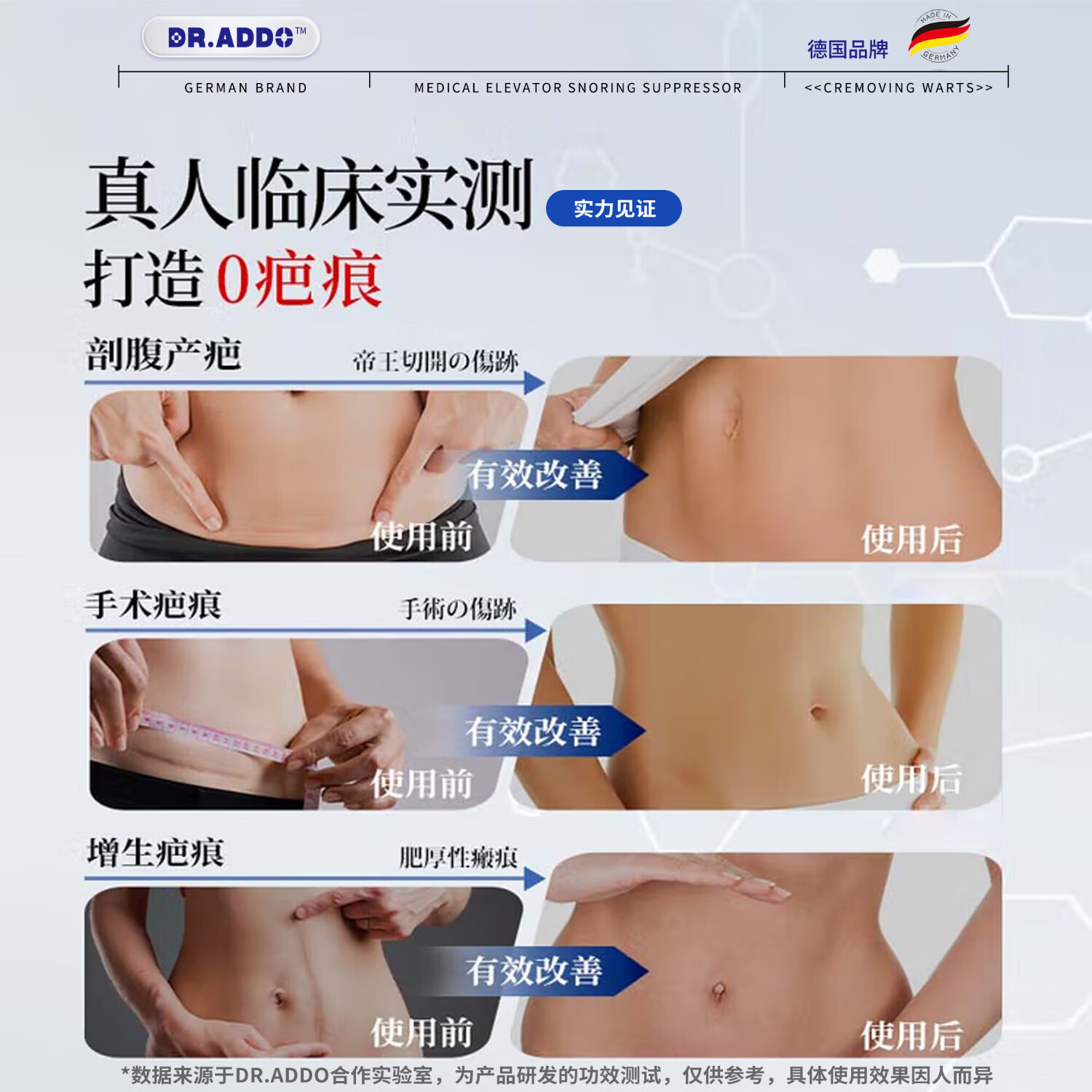 DR.ADDO医用疤痕贴剖腹产手术烧伤烫伤疤痕硅凝胶疤痕贴增生凸起去除疙瘩 1盒体验装【德系品质 药店同款】 剖腹产疤痕贴京棟自蓥官方旗舰店非丽森卡美皮肤疤痕贴