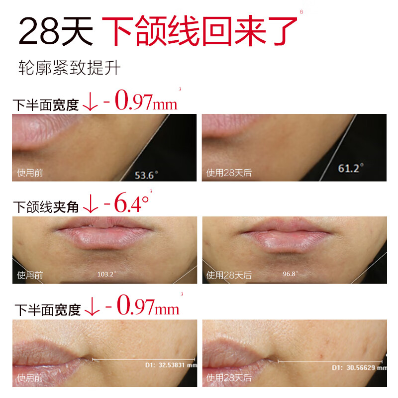 丸美双胶原小金针面霜抗皱紧致修护淡纹补水保湿面霜护肤品生日礼物女 【新品上线】小金针特润霜50g