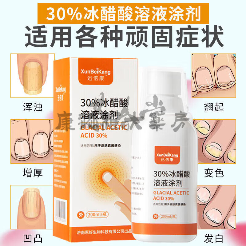 【藥房直售】迅倍康30%冰醋酸溶液涂劑稀釋液外用抑菌液抗菌液抗 迅倍康灰指甲專用 1盒灰指甲專用30%冰醋酸溶液