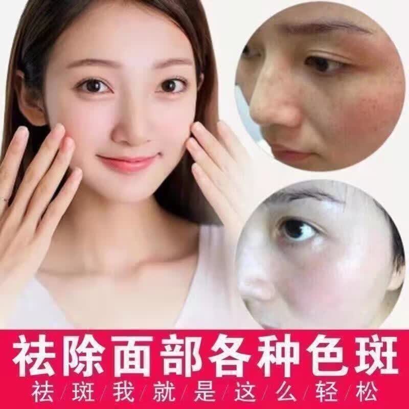 愉心堂美白祛斑霜祛黄褐斑雀斑老年斑淡化色斑提亮肤色京仓配送 愉心堂美白祛斑霜 两支装