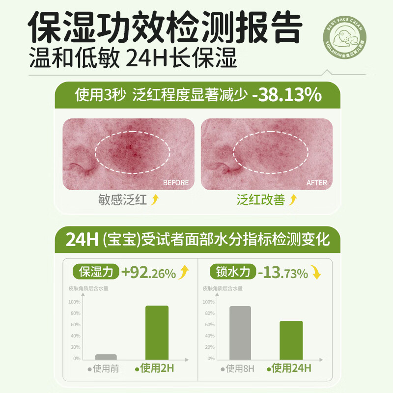 KoalaMan考拉侠澳洲进口金盏花面霜50g婴儿宝宝霜滋润保湿舒缓修护苹果脸 【热卖爆品】金盏花保湿霜50g/瓶