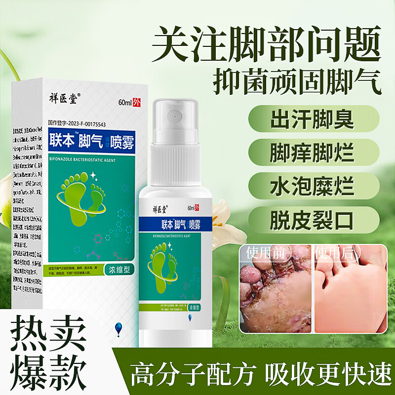 祥医堂联本脚气喷雾脚痒脚汗脚臭喷雾脱皮烂脚丫水泡型专用脚气喷剂 脚气抑菌液60ml-2瓶