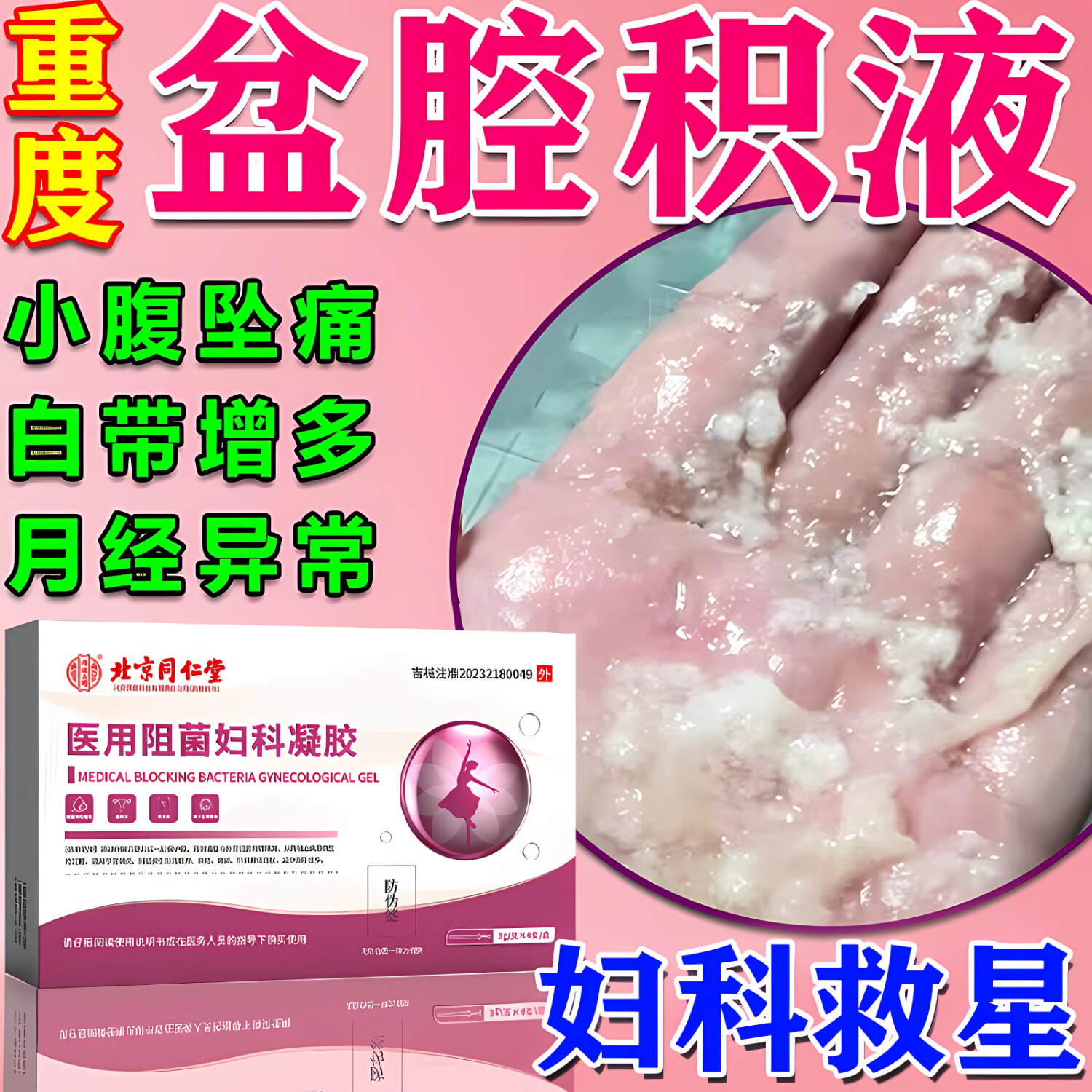 北京同仁堂盆腔炎盆腔积液妇科凝胶消炎抑菌用药小腹坠痛腰附件炎排积液专用 1盒【有炎症】宫颈异物