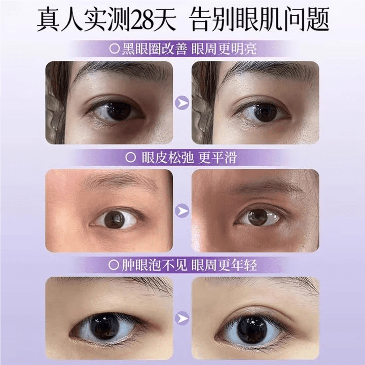 贝因维丝眼袋消肿液芙诗婷咖啡因淡化细纹眼袋精华油双眼皮紧致 3支装 官方直售