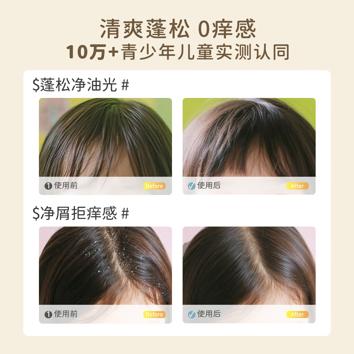 TOOFRUIT多果肤有机儿童青少年洗发水 3-6-12岁男女清爽止痒防头屑无硅油 [98%选择控油净屑]200ml