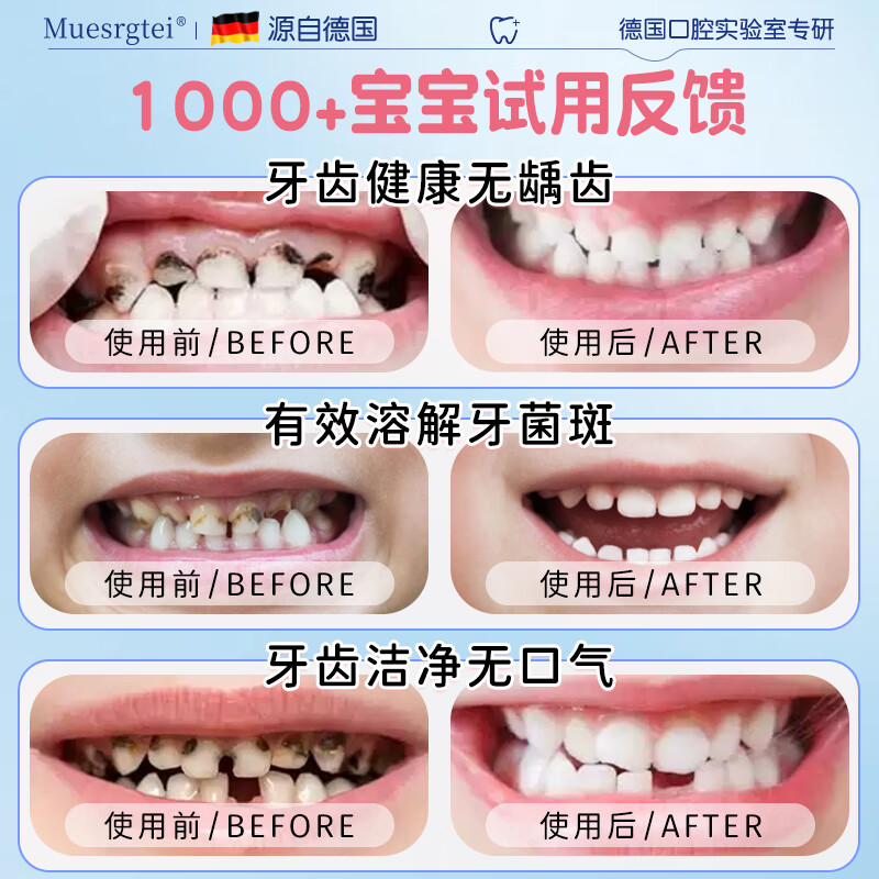 MUESRGTEI德国高端儿童牙膏3-6-12岁防蛀含氟抗糖抑菌金榜第一牙洞修复抑菌