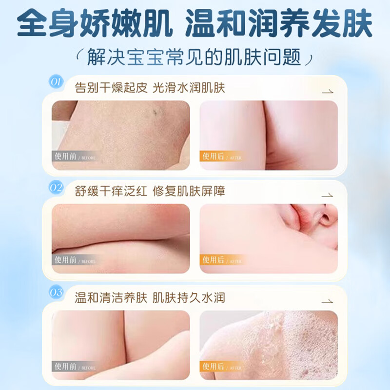 初蔓儿童洗发水沐浴露二合一3-6-12岁婴幼儿宝宝去止痒屑洗护沐浴乳液 【儿童专研】洗发沐浴二合一600ml 冠军推荐儿童洗发沐浴二合一TOP