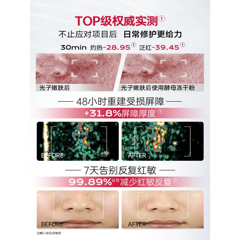 优理氏【褪红修护】酵母冻干粉修护呵护敏感肌肤屏障退红冻干絮次抛精华 【改善红痒痛】酵母冻干粉20支