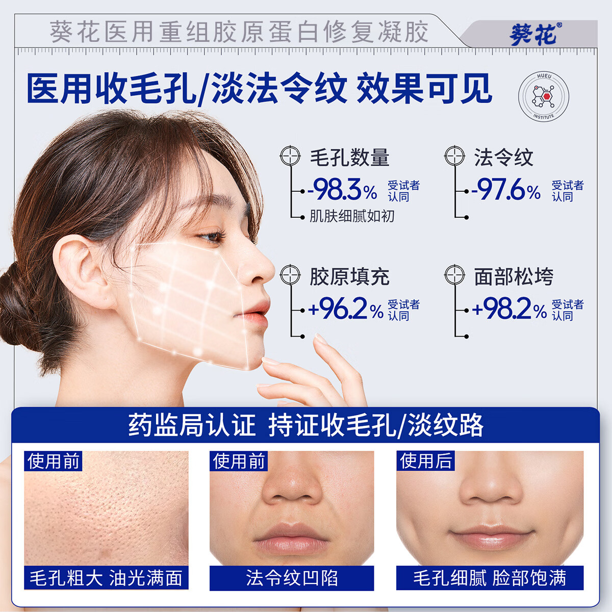 葵花医用重组三型人源化胶原蛋白修护凝胶抬头法令纹口角囊袋修复专用 五盒装【告别细纹 皮肤细腻18岁】