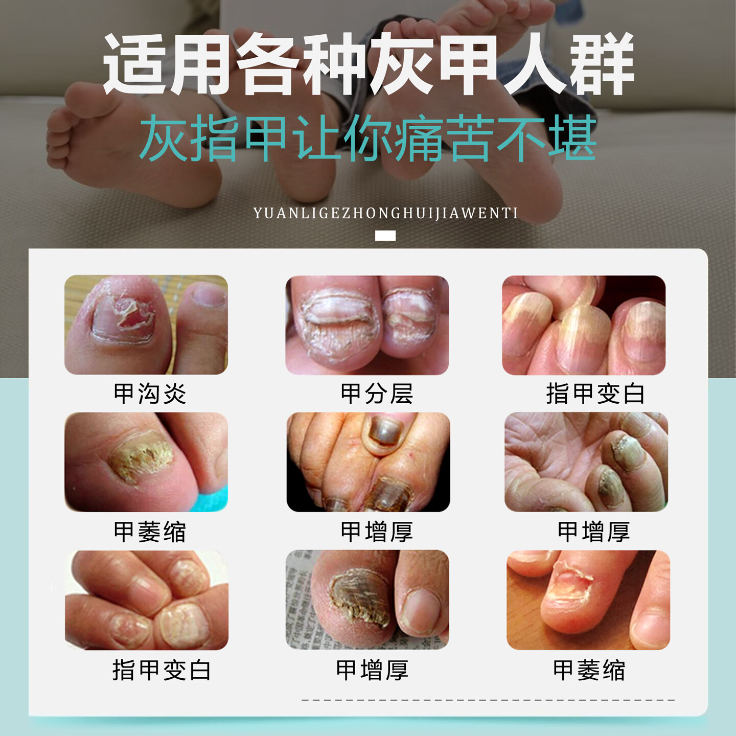 润芷堂灰指甲专用套装【30天可退】甲增厚变白甲萎缩分层甲沟炎凹凸不平 1234 号液整套 （3个指甲量）