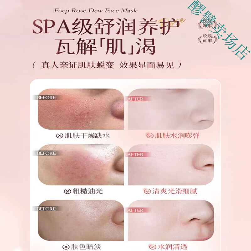 MRYU鲜花面膜玫瑰洋甘菊舒缓修复补水熬夜急救去黄提亮以花养肤焕颜
 【各1盒】玫瑰面膜+洋甘菊面膜 10片/盒