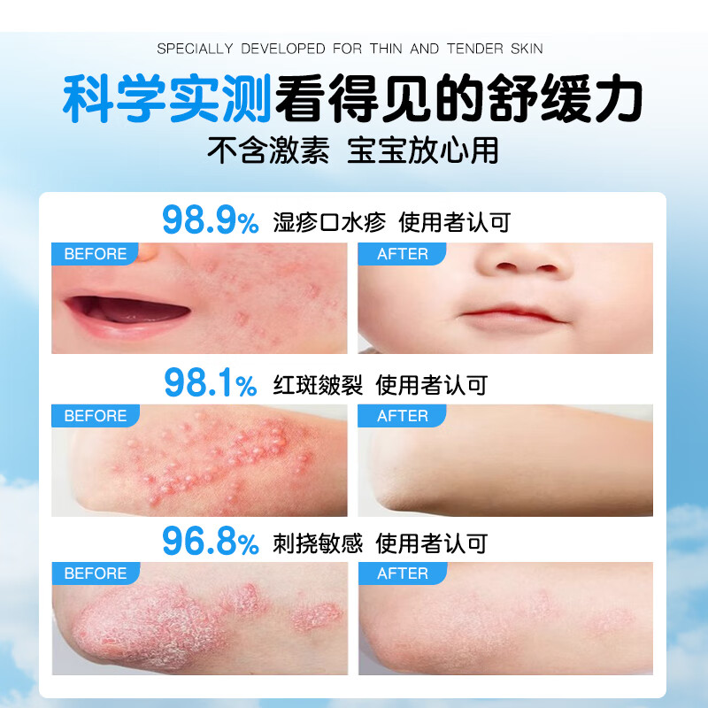 GEKX医用湿疹止痒膏婴幼儿专用宝宝儿童身体乳口水疹无激素皮炎瘙痒 1盒装 100ml【贵在运费 不推荐】