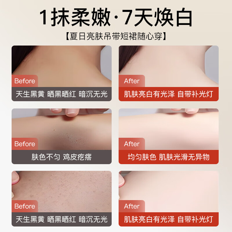 suremoco进口果酸美白身体乳提亮持久留香72小时香体保湿补水滋润干燥皮肤 【根源祛黑】三瓶巩固回购装