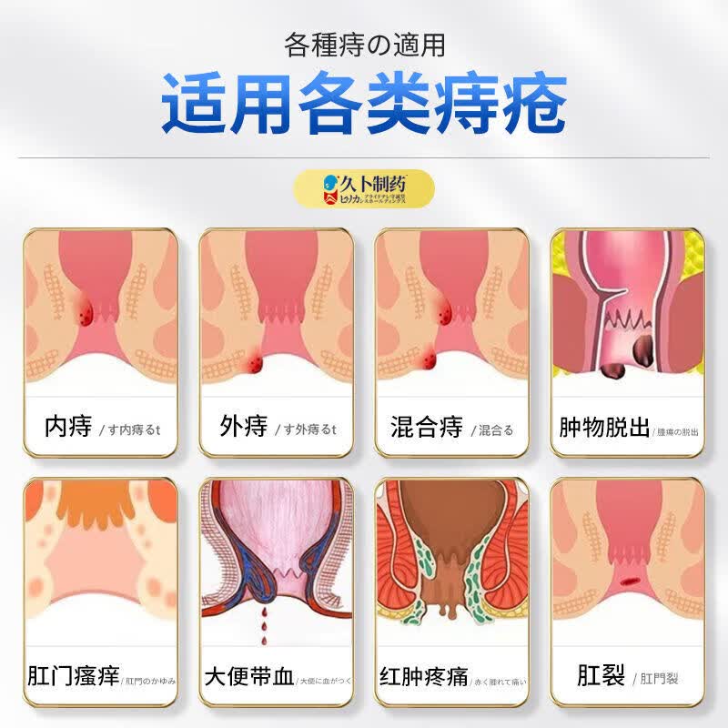 久卜制药痔疮凝胶专用去肉球内外混合去痔疮止痒肛门瘙痒肛裂便血便秘消痔 痔疮专用凝胶*1盒